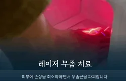 통합/랜딩/발톱/문제성발톱/1만원/241010(pc/페이지 추가)
